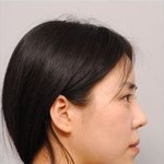 사진無 ) 주걱턱으로 사는 삶이란 ㅋ