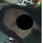 님들 제발 ㅜ 제 <b>이마</b>가 얼마나넓은지 봐주세요 !!(사진有)