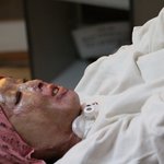 (사진有..)제 얼굴이 휘발유에 녹아버렸습니다..