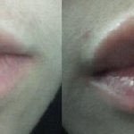 요즘 <b>입술</b>건조증에 시달리면서..