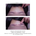 [스크랩] <b>이마</b>가 좁은여잨ㅋㅋㅋㅋㅋㅋㅋㅋㅋ