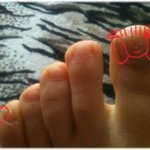 사진有:)<b>발톱</b>자르다생긴일!!●_●조심!!!!!!!