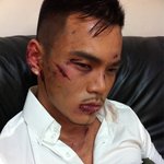 술집에서 원빈<b>욕</b>했다가 <b>여자</b>들한테할퀴고 폭행당했어요 [사진有]