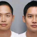 성형<b>수술</b> 후 훈남?으로 변신해다는 김형인 전과 후