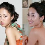 전혜빈도 만족한 성형