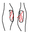 <b>다리</b> 알 생기는 <b>부분</b>