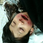 이러다가 죽을것만 같습니다..알려주세요. 부탁드립니다.