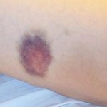 사진有)  슈퍼에서 도둑누명 쓰고 맞았어요