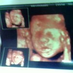 입체촘파부터 <b>백일</b>지나서까지 변천사예요 ㅎㅎㅎ