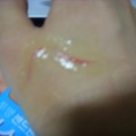 고양이 카페에서 고양이에게 난 <b>상처</b>