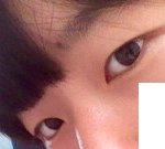 언니들!!!!!!!!!<b>주위</b>에서쌍수하라고그러는데 내눈좀봐줘ㅠㅠㅠ!...
