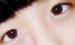 <b>눈</b>이 짝짝<b>이</b> ...