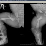 의료사건에 대한 많은 댓글을 달아주신분들 진심으로 감사드립니다....