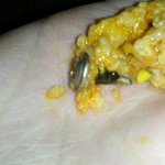 삼각김밥에서 나사못이 나왔습니다‥‥