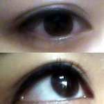 <b>쌍수</b> <b>티</b> 나나요?ㅠ