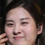 보톡스 맞은 '서현'얼굴