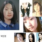<b>의학</b>의 힘으로 예뻐진 여자 연예인들?
