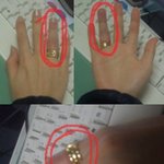 <b>반지</b>가안빠져요 어떻게해요?ㅠㅠㅠㅠㅠㅠㅠㅠㅠㅠㅠㅠㅠㅠㅠ