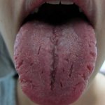사진有) 나같은 혀 가진사람있음? 아님 나 어디 아픈거임?