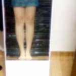 쌍수 고민 + 다리굵기