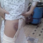 경찰의 느긋한 일처리, 광신고속 160번 버스회사의 <b>발뺌</b>을 고발한다.