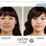 우리나라 성형의 대단함.. 사진有