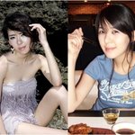 이파니,이파니 부정교합으로 <b>양악</b>수술