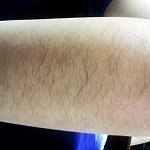 <b>팔털</b>이너무많아요ㅠㅠ