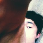 맞아 얼굴이 <b>다가</b>아니야