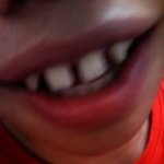 이정도<b>이빨</b>이면 군대안가나요....?(고민상담)1탄