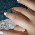 ★★사진有) 퍽치기 당했습니다!!!!!!!!!!!!!!!!!!!...