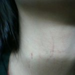 친남동생에게 살해<b>위협</b> 받았어요...[사진추가]