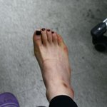 맨발에 구두.. 조심하세요..ㅜㅜ 저처럼 <b>무좀</b>크림 달고다녀야해요.