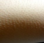 사진有) 바퀴벌레와의 일방적인 혈투＼/