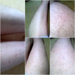 사진有) 다리털이 많아 고민인여자? 아닙니다 온몸에 털이 많아 고민인...