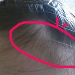 사진有 16살 머리숱없는여자입니다..도와주세요