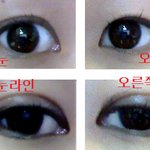 쌍커풀 짝짝<b>이</b> <b>눈</b>좀봐줘요'0' 앞트임해야되까??