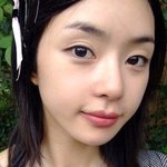 쌍수의 좋은예, 여자 연예인 앞트임 <b>뒤트임</b>