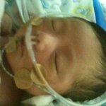 우리 아기는 얼마나 살아줄수 있을까요.....