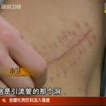 아이패드2 <b>사려</b>고 콩팥 팔아넘긴 中 10대