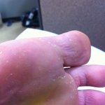 여름되니 발이 더 간지럽고 냄새도 심하고.. <b>무좀</b> 지겹다..