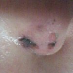 사람얼굴에 <b>담배빵</b>이 가당키나합니까?억울해요[내용+]