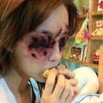 앞이 안 보인다는 '티아라' <b>효민</b>