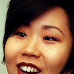 양악수술로 대변신한 그녀들!!!!▶<b>돌출</b>입양악수술.주걱턱양악수술