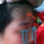 (사진有) 버스에서 졸다가? <b>nono</b>, 축구하다가 생긴 일