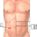 <b>임재범</b> 정말 맹장수술 했나?????