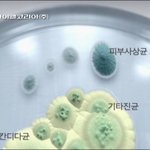 <b>무좀</b> 걸리신 분들을 위해..