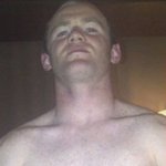 루니 <b>모발</b>이식 그 후가 궁금하다~!!!