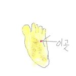 모기물렸을때....공감99.56526%