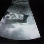 출산일이 다가옵니다.....